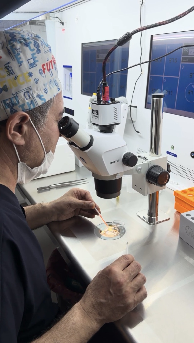 Fertina IVF embriyoloğu mikroskop altında mikroenjeksiyon (ICSI) işlemi yapıyor